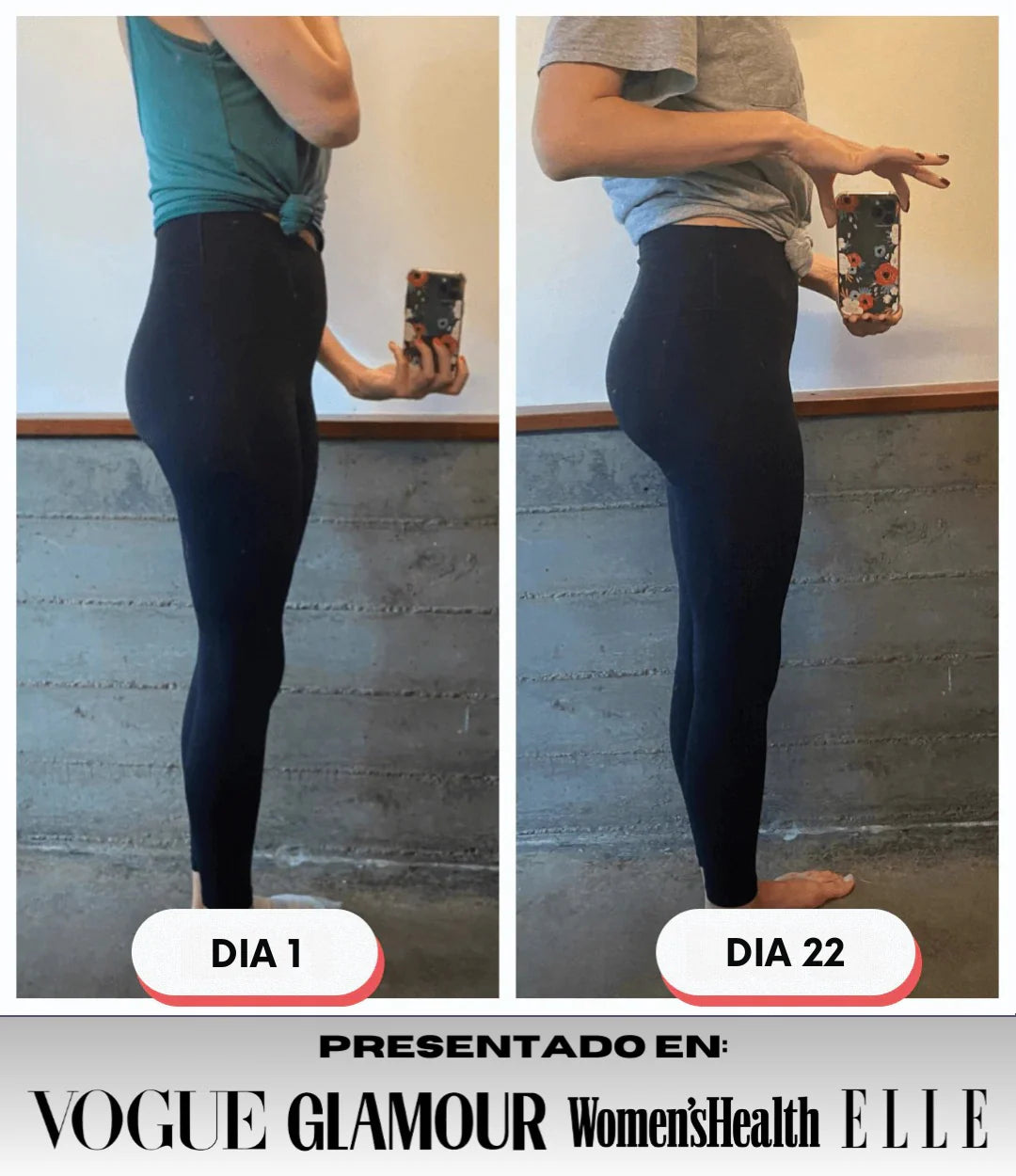 Estimulador de Glúteos BumTonic®