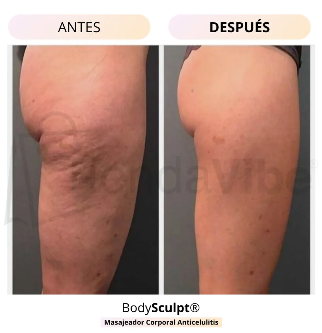 BodySculpt Masajeador Anticelulitis + Electro Estimulador de Glúteos de Regalo