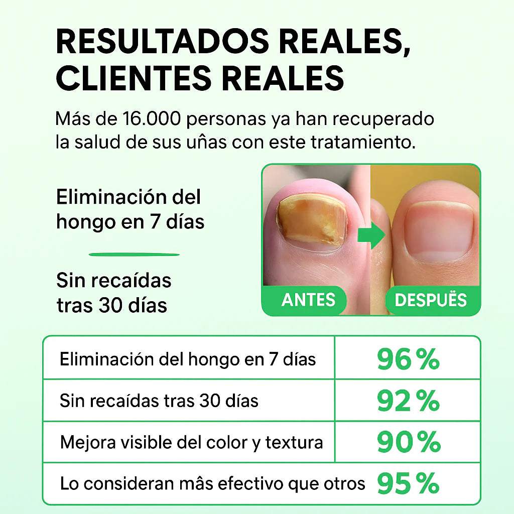 Fungiclear 7™ - TRATAMIENTO ANTI HONGOS 7 DÍAS 100% NATURAL