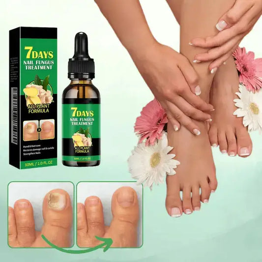 Fungiclear 7™ - TRATAMIENTO ANTI HONGOS 7 DÍAS 100% NATURAL