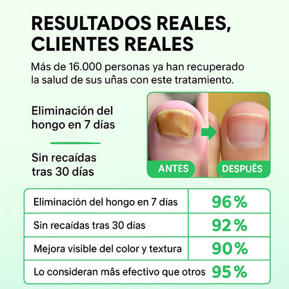 Fungiclear 7™ - TRATAMIENTO ANTI HONGOS 7 DÍAS 100% NATURAL