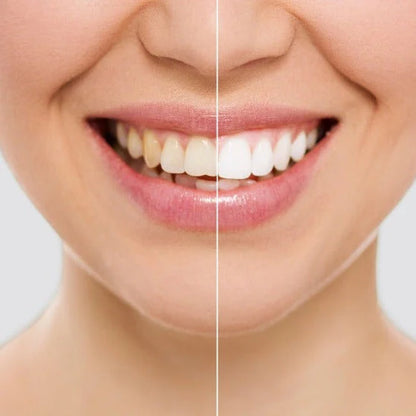 LÁPIZ BLANQUEADOR DE DIENTES CON FÓRMULA MEJORADA - SMILE WHITE™ 2x1